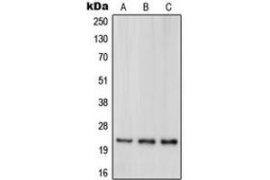 Western blot analysis of DJ-1 expression in HeLa (A), HEK293T (B), Jurkat (C) whole cell lysates. (PARK7/DJ1 anticorps  (Center))