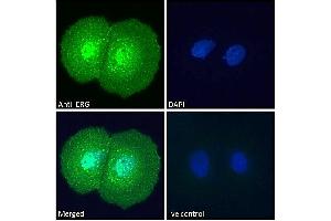 ABIN185550 Immunofluorescence analysis of paraformaldehyde fixed MCF7 cells, permeabilized with 0.