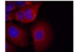 Image no. 3 for anti-Glycogen Synthase Kinase 3 alpha (GSK3a) (Ser21) antibody (ABIN197104)