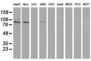 Image no. 3 for anti-Protein Kinase C, epsilon (PRKCE) antibody (ABIN1500235) (PKC epsilon anticorps)