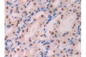 Detection of Ab1-42 in Human Stomach Tissue using Monoclonal Antibody to Amyloid Beta Peptide 1-42 (Ab1-42)