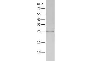 Western Blotting (WB) image for BPI Fold Containing Family A, Member 1 (BPIFA1) (AA 20-256) protein (His-IF2DI Tag) (ABIN7122016)
