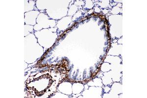 Anti-Collagen I antibody, IHC(P): Rat Lung Tissue