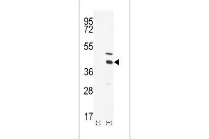 Western blot analysis of DOK4 using DOK4 Antibody using 293 cell lysates (2 ug/lane) either nontransfected (Lane 1) or transiently transfected with the DOK4 gene (Lane 2). (DOK4 anticorps  (C-Term))