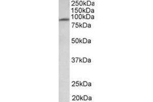 AP31934PU-N MFSD6 antibody staining of Human Heart lysate at 1 µg/ml (35µg protein in RIPA buffer). (MFSD6 anticorps  (Extracellular Domain))