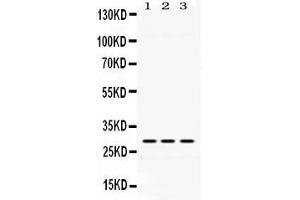 Western blot analysis of ADO expression in rat testis extract ( Lane 1), mouse kidney extract ( Lane 2) and HELA whole cell lysates ( Lane 3).