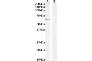ABIN185029 staining (2µg/ml) of nuclear HEK293 (A) and (1ug/ml) negative control Human Pancreas (B) lysate [RIPA buffer, 35µg total protein per lane).