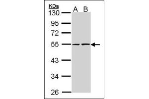 Sample (30 µg of whole cell lysate). (RUVBL2 anticorps  (Ser129))