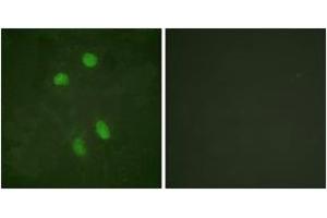 Immunofluorescence (IF) image for anti-Activating Transcription Factor 2 (ATF2) (AA 456-505) antibody (ABIN2888781) (ATF2 anticorps  (AA 456-505))