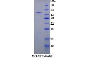 SDS-PAGE analysis of Rat NT5C3 Protein. (NT5C3 Protéine)