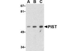 AP20061PU-N PIST antibody staining of PC-3 Cell Lysate by Western Blotting at (A) 1, (B) 2 and (C) 4 μg/ml. (GOPC anticorps  (Middle Region))