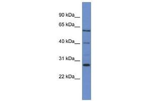 Western Blot showing CYP24A1 antibody used at a concentration of 1-2 ug/ml to detect its target protein. (CYP24A1 anticorps  (C-Term))