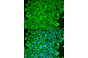 Immunofluorescence analysis of HeLa cells using SGCE antibody. (SGCE anticorps)