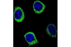 anti-Amylase, alpha 2B (Pancreatic) (AMY2B) (AA 77-105), (N-Term) antibody