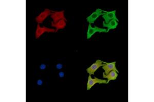 ABIN7096815 and ABIN7100881 staining Hela cells by IF/ICC.