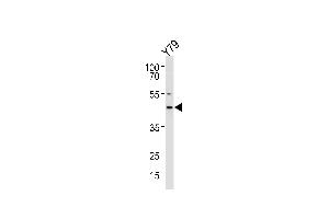 RDH10 Antibody (Center) (ABIN650935 and ABIN2840001) western blot analysis in Y79 cell line lysates (35 μg/lane). (RDH10 anticorps  (AA 106-135))