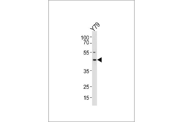 RDH10 anticorps  (AA 106-135)
