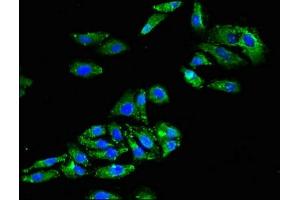Immunofluorescent analysis of HepG2 cells using ABIN7153601 at dilution of 1:100 and Alexa Fluor 488-congugated AffiniPure Goat Anti-Rabbit IgG(H+L)