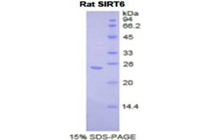 SDS-PAGE analysis of Rat Sirtuin 6 Protein. (SIRT6 Protéine)