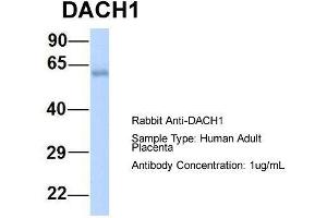 Host:  Rabbit  Target Name:  DACH1  Sample Type:  Human Adult Placenta  Antibody Dilution:  1. (DACH1 anticorps  (N-Term))
