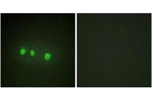 Immunofluorescence analysis of HepG2 cells, using ZIC1/2/3/4/5 Antibody. (ZIC1/2/3 anticorps  (AA 281-330))