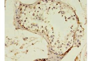 Immunohistochemistry of paraffin-embedded human testis tissue using ABIN7170663 at dilution of 1:100