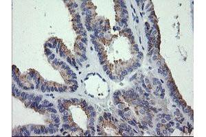 Image no. 3 for anti-Cancer/testis Antigen 1B (CTAG1B) antibody (ABIN1499898) (CTAG1B anticorps)