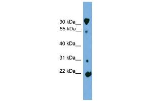 WB Suggested Anti-KLHL2 Antibody Titration: 0. (KLHL2 anticorps  (Middle Region))
