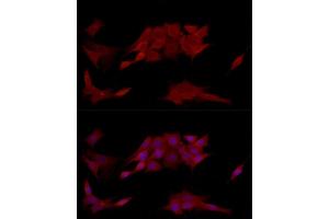 Immunofluorescence analysis of NIH/3T3 cells using [KO Validated] PTPN2 Rabbit pAb (ABIN3022584, ABIN3022585, ABIN3022586, ABIN1513448 and ABIN6218927) at dilution of 1:250 (40x lens).