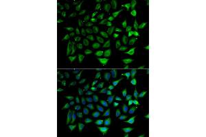 Immunofluorescence analysis of HeLa cell using SLC25A20 antibody. (SLC25A20 anticorps)