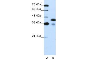 WB Suggested Anti-TARDBP Antibody Titration:  1. (TARDBP anticorps  (C-Term))