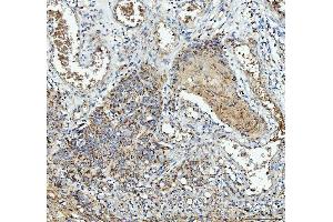 IHC analysis of IL1RA using anti-IL1RA antibody (ABIN5518923).