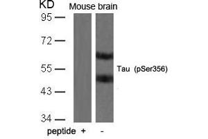 Western blot analysis of extracts from mouse brain tissue using Tau(Phospho-Ser356) Antibody and the same antibody preincubated with blocking peptide. (MAPT anticorps  (pSer356))