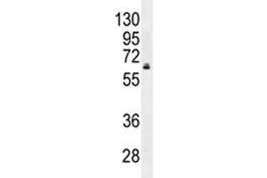 HNF1B antibody western blot analysis in MDA-MB231 lysate. (HNF1B anticorps  (AA 498-529))