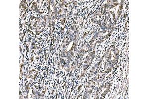 IHC analysis of CBX2 using anti-CBX2 antibody (ABIN7599466). (CBX2 anticorps  (AA 1-532))