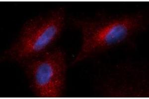 Immunofluorescence (IF) image for anti-Complement Factor Bb antibody (PE) (ABIN5564992) (Complement Factor Bb anticorps  (PE))