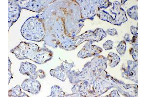 IHC analysis of DYNLT1 using anti-DYNLT1 antibody .