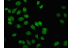 Immunofluorescent analysis of A549 cells using ABIN7153171 at dilution of 1:100 and Alexa Fluor 488-congugated AffiniPure Goat Anti-Rabbit IgG(H+L)