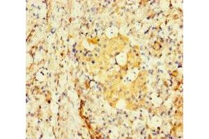 Immunohistochemistry of paraffin-embedded human pancreatic tissue using ABIN7171622 at dilution of 1:100 (TBC1D24 anticorps  (AA 1-169))