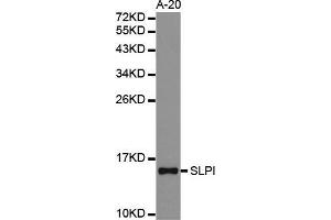 Western blot analysis of extracts of A-20 cell lines, using SLPI antibody. (SLPI anticorps  (AA 26-132))