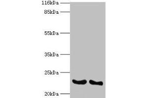 Western blot All lanes: IFNA14 antibody at 2 μg/mL Lane 1: A549 whole cell lysate Lane 2: Mouse heart tissue Secondary Goat polyclonal to rabbit IgG at 1/10000 dilution Predicted band size: 23 kDa Observed band size: 23 kDa (IFNa14 anticorps  (AA 24-189))
