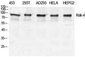 Western Blotting (WB) image for anti-Ribosomal Protein S6 Kinase, 90kDa, Polypeptide 6 (RPS6KA6) (C-Term) antibody (ABIN3177309) (RPS6KA6 anticorps  (C-Term))