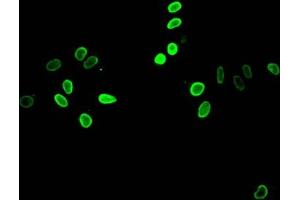 Immunofluorescent analysis of Hela cells treated by NaB using ABIN7139153 at dilution of 1:100 and Alexa Fluor 488-congugated AffiniPure Goat Anti-Rabbit IgG(H+L)