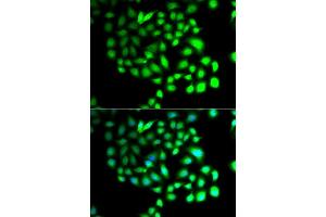 Immunofluorescence analysis of A549 cells using TCEAL8 antibody (ABIN5974946).
