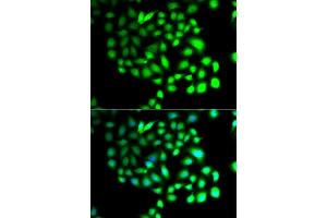 Immunofluorescence analysis of A549 cells using TCEAL8 antibody (ABIN5974946).