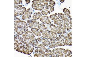 Immunohistochemistry of paraffin-embedded mouse pancreas using RPS15A Rabbit pAb (ABIN6131092, ABIN6147201, ABIN6147202 and ABIN6214414) at dilution of 1:200 (40x lens). (RPS15A anticorps  (AA 1-130))