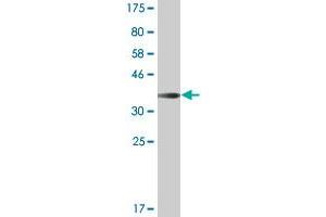 Western Blot detection against Immunogen (37. (ARHGAP6 anticorps  (AA 531-636))