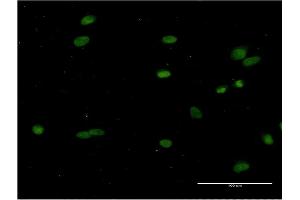 Immunofluorescence of monoclonal antibody to CRY1 on HeLa cell. (CRY1 anticorps  (AA 1-586))