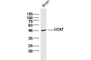 Mouse brain lysates probed with LCAT Polyclonal Antibody, Unconjugated  at 1:300 dilution and 4˚C overnight incubation. (LCAT anticorps  (AA 151-250))