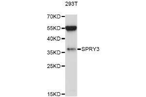 Western blot analysis of extracts of 293T cells, using SPRY3 antibody (ABIN6293588) at 1:1000 dilution. (SPRY3 anticorps)